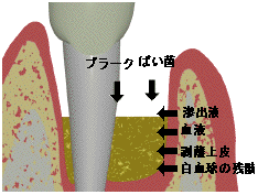 |Pbg͍׋ۂƐZotAtAA̎c[A׋ۂ̏oyfAoyfłӂĂB